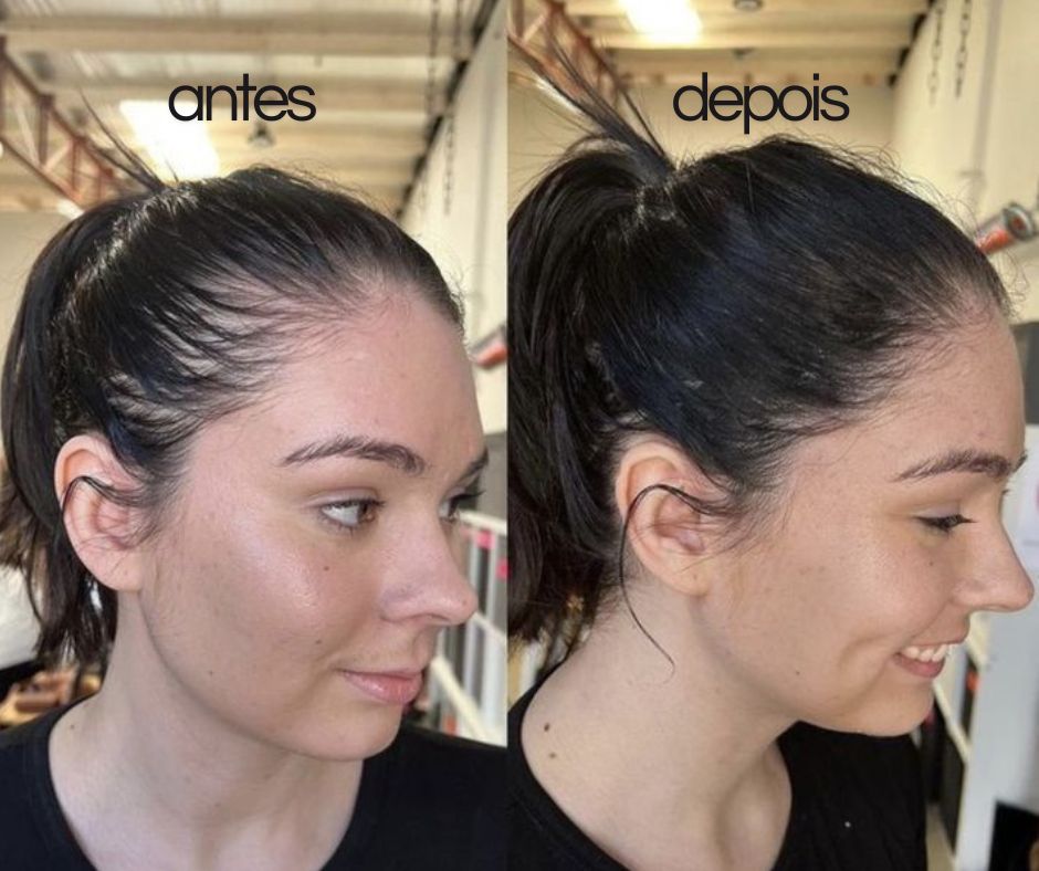 Escova de massagem inteligente