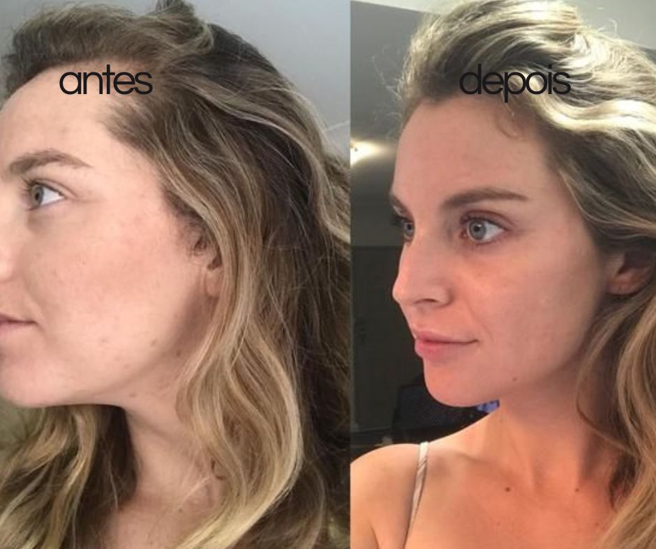 Escova de massagem inteligente